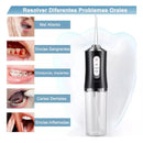 🦷 Irrigador Bucal Eléctrico Portátil – Limpieza Dental Profesional en Casa